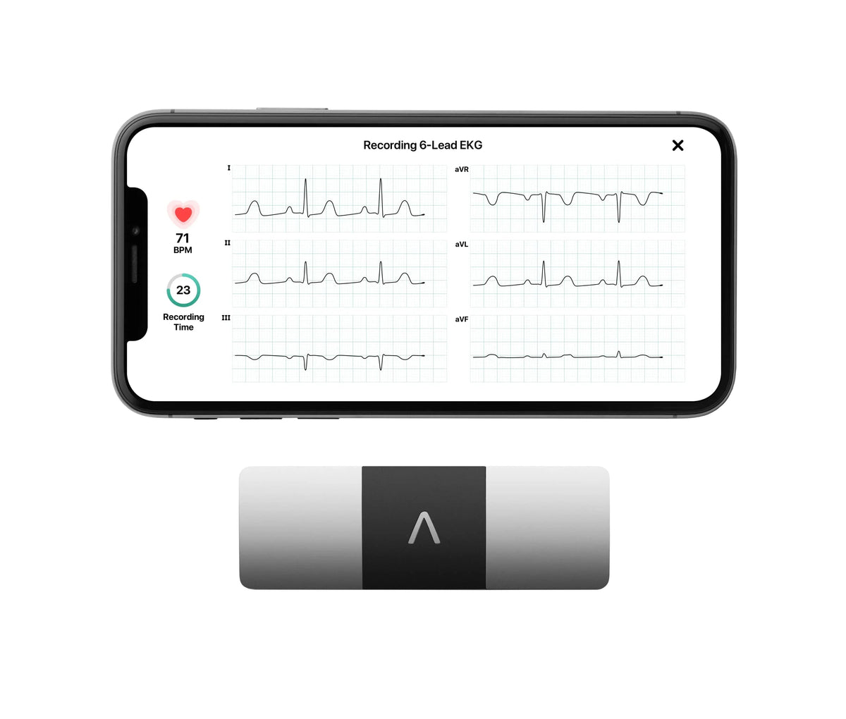 AliveCor KardiaMobile 6L Personal EKG Monitor, Black - KM-6L-E